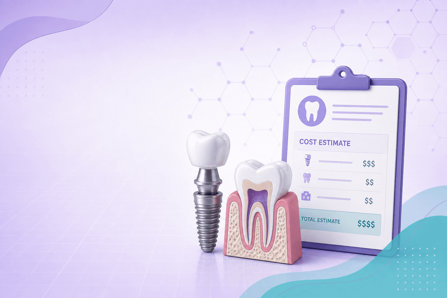 Dental implant cost calculator illustration